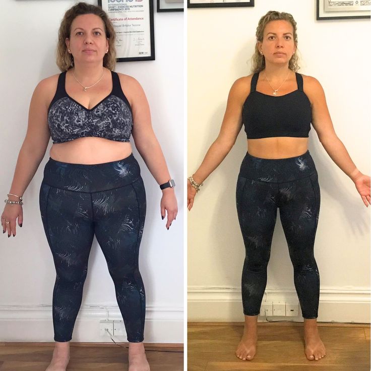 Fotos Antes E Depois